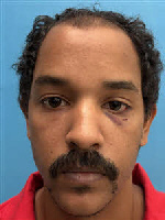 Mugshot of Anthony Rashad Baez