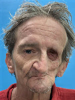 Mugshot of Joseph Dale Bellows